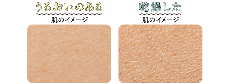 うるおいのある肌のイメージ　乾燥した肌のイメージ